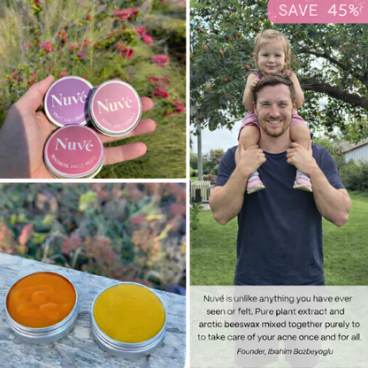 Nuvé™ Acne & Redness Reset Ritual
