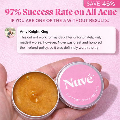 Nuvé™ Acne & Redness Reset Ritual