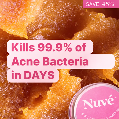 Nuvé™ Acne & Redness Reset Ritual